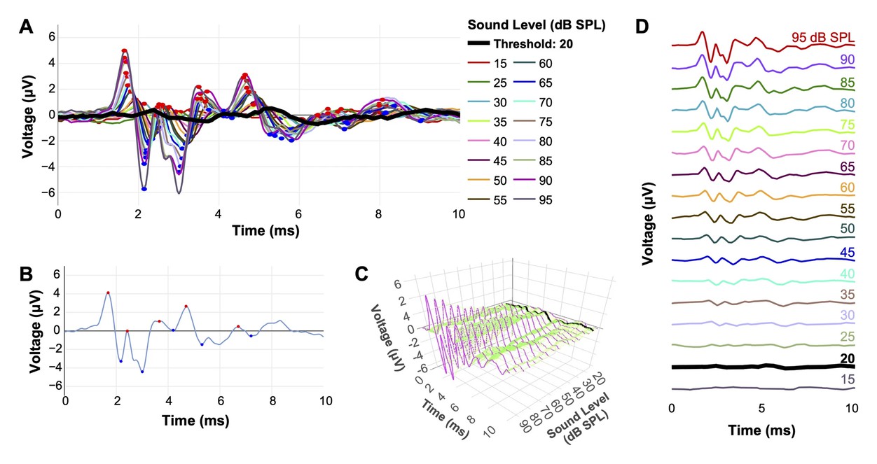 Auditory brainstem response waveforms analyzed across sound levels, with automated peak detection and hearing threshold estimation